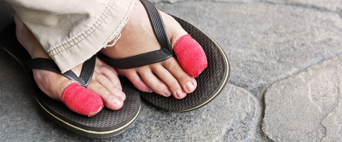 Ingrown-Toenails-Causes-Prevention-and-How-g-defy-Can-Help G-defy