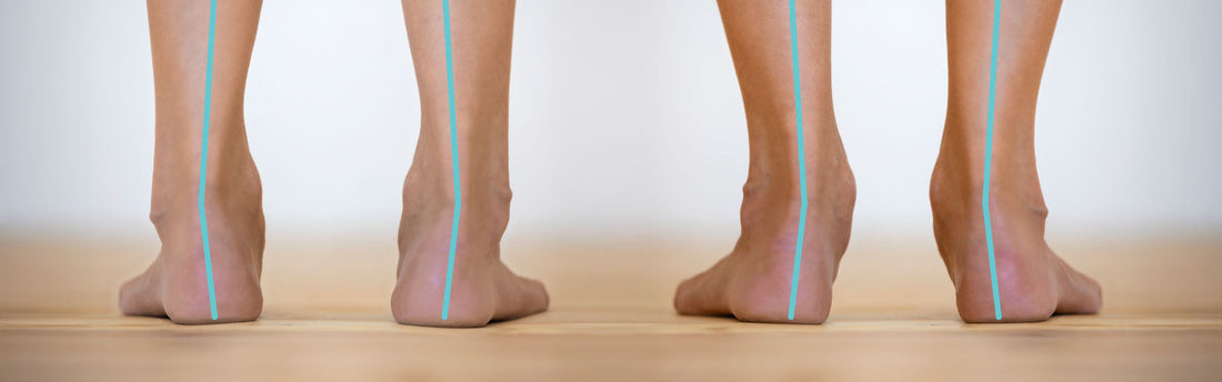 What-s-The-Difference-Between-Pronation-and-Supination G-defy