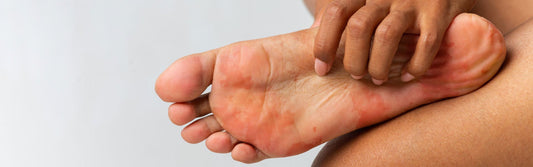 Can Diabetes Cause Foot Pain? - G-defy