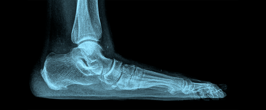 Flat Feet Pain? Discover the Best Shoes for Arch Support and All-Day Comfort - G-defy