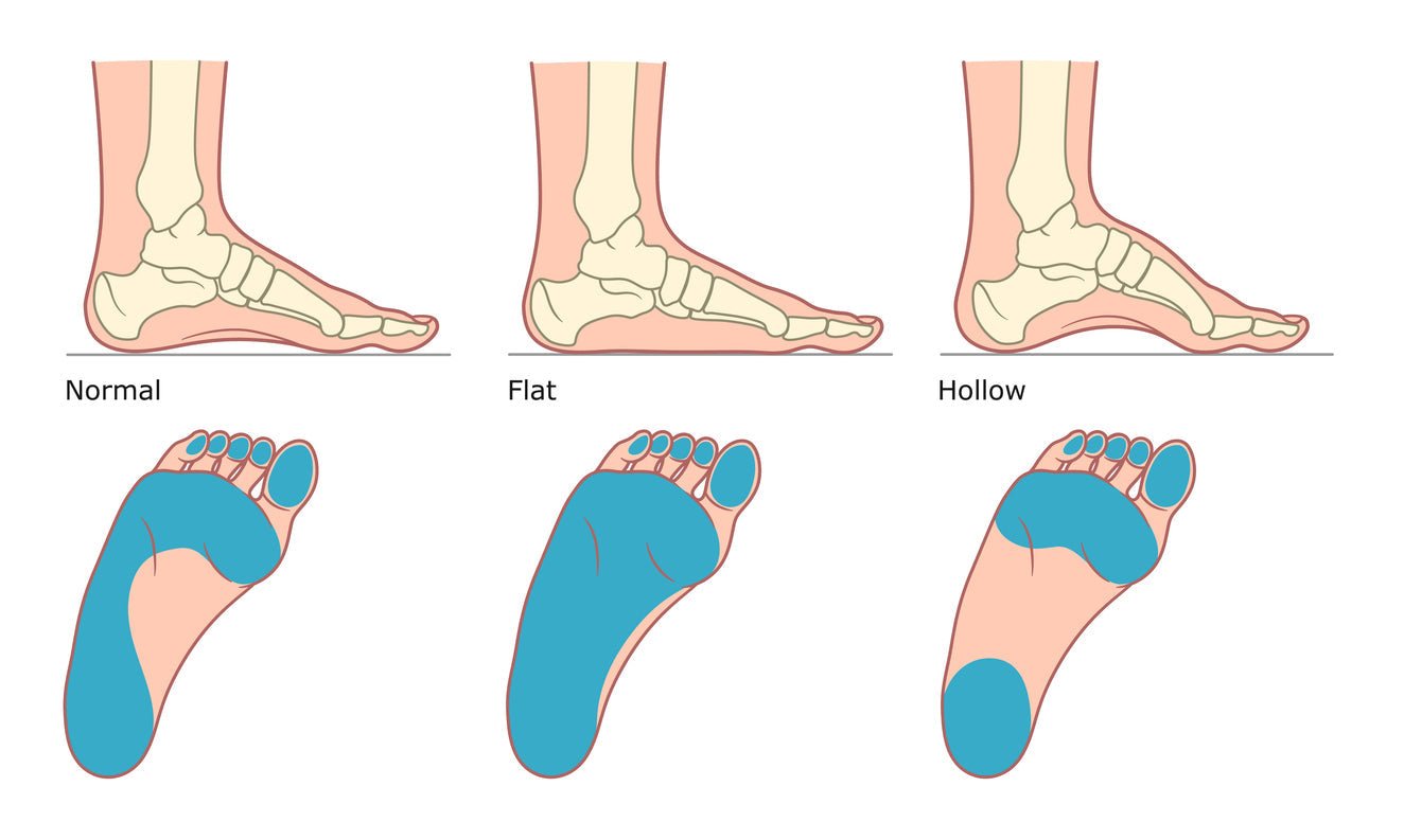 Wide Feet Guide: How to Tell + Find the Right Fit (2026) – G-defy