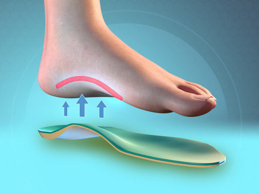 Benefits of High Arch Support Inserts