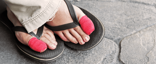 Ingrown Toenails: Causes, Prevention, and How g-defy Can Help - G-defy