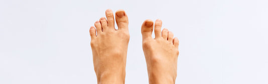 Morton’s Neuroma & Morton’s Toe: What You Need to Know and How g-defy Shoes Can Help - G-defy