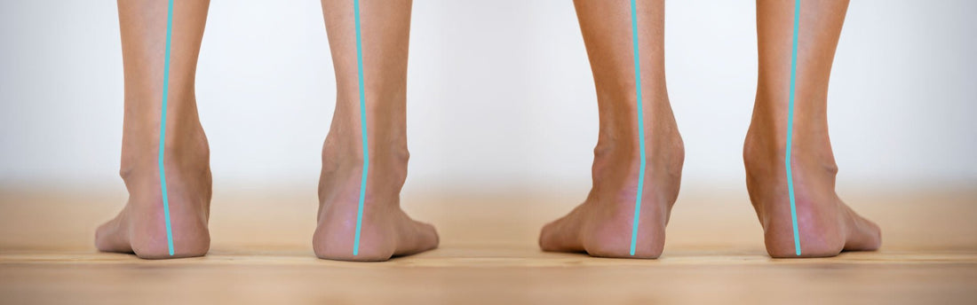 What's The Difference Between Pronation and Supination? - G-defy