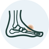 Arthritis