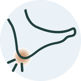 Heel pain