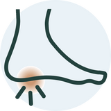 Heel spurs