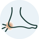 Plantar fasciitis