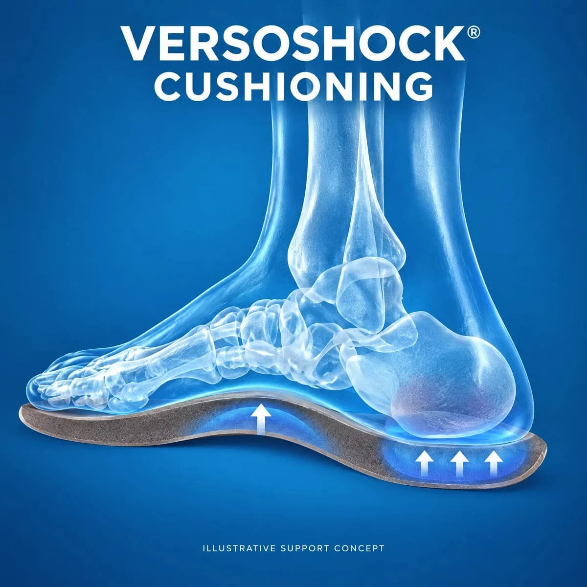 Illustrative anatomical foot-support concept labeled VersoShock cushioning, not a clinical demonstration