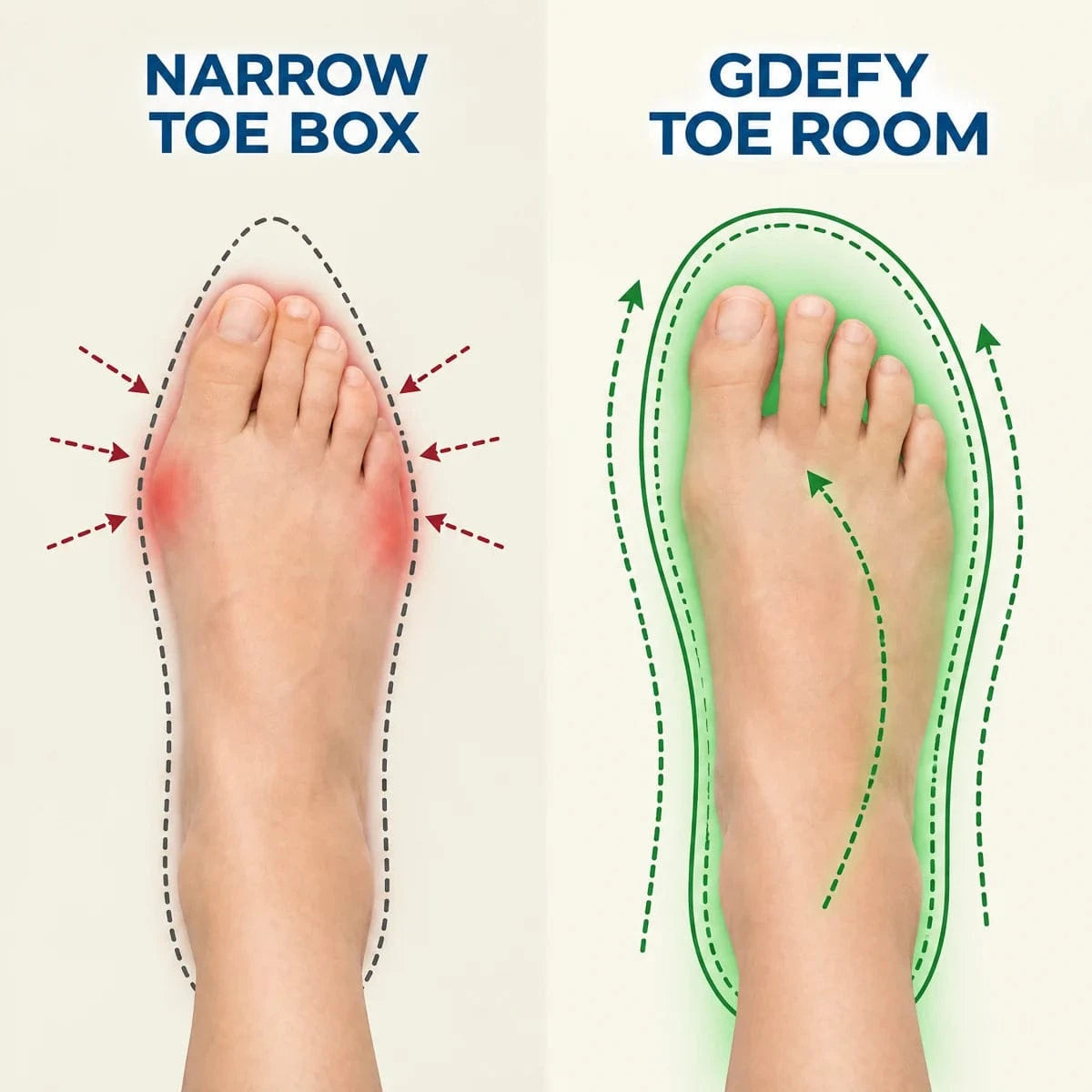 Illustrative comparison of a narrow toe box and the space provided by a roomy GDEFY toe box